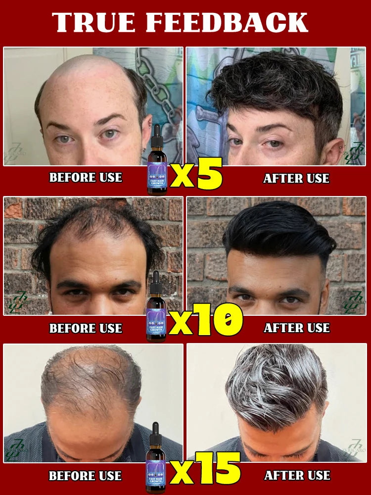 S6f5c1121763e409087a81c7b12b6fe36T